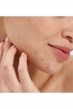 Outlet PAI Booster purifiant  à l’acide salicylique