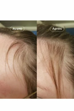 Outlet Omum Compléments Alimentaires croissance cheveux Mon Coup de Pousse Nutricosmétique