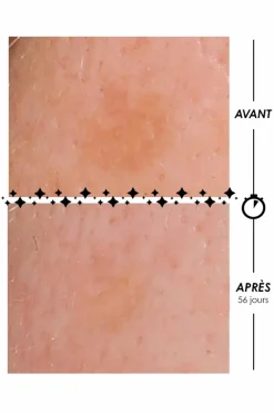 Best Garancia Crème lactée anti-taches La Foudroyante Eclair de Lune à l’advanced Retinol-Like