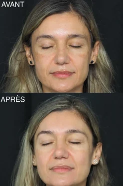 Sale Patyka Fluide anti-taches haute protection SPF30