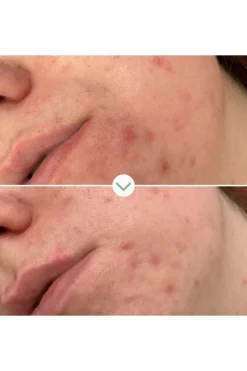 New PAI Gel nettoyant purifiant Phaze