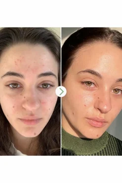 Sale PAI Huile de nuit anti-imperfections Carbon Star