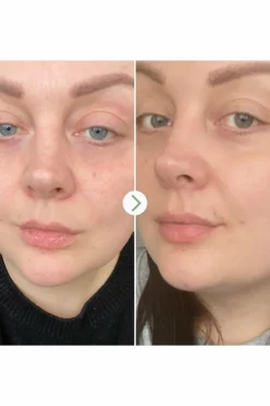 New PAI Huile visage universelle Rosehip BioRegenerate