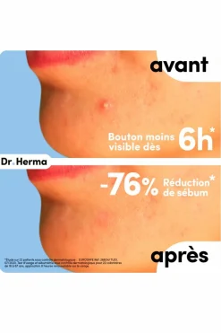 Clearance DR HERMA Patch anti-boutons format petit