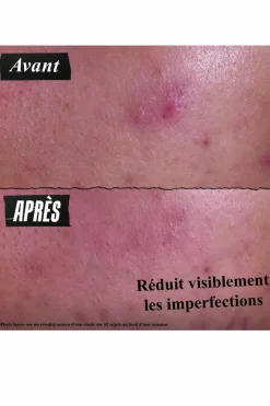 Online Kiehl's Pâte Anti-Imperfections 3-en-1