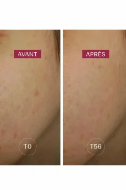 Discount LABORATOIRES DE BIARRITZ Sérum anti-taches