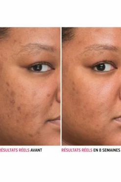 New it Cosmetics Sérum anti-taches à la niacinamide Bye Bye Serum