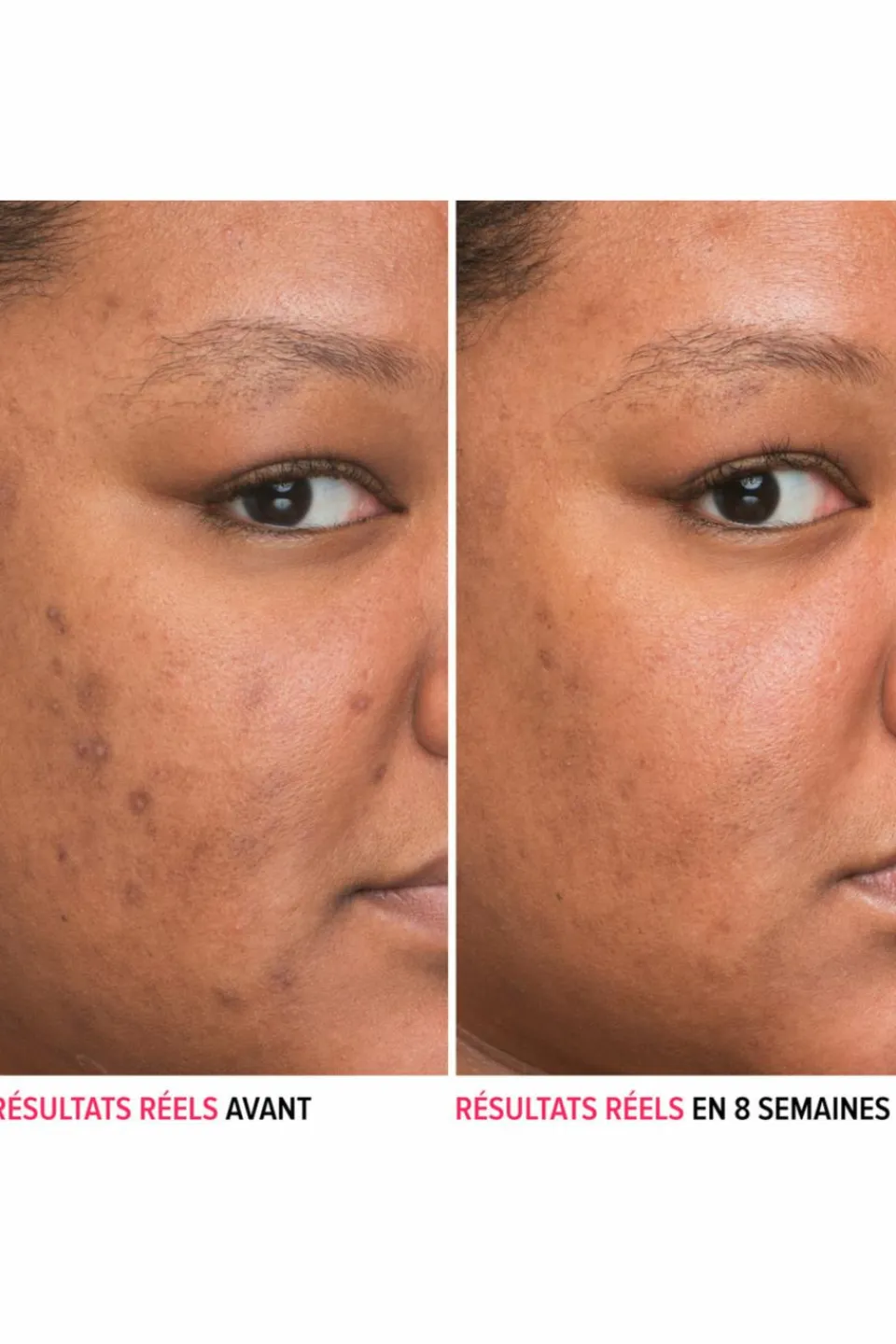 New it Cosmetics Sérum anti-taches à la niacinamide Bye Bye Serum